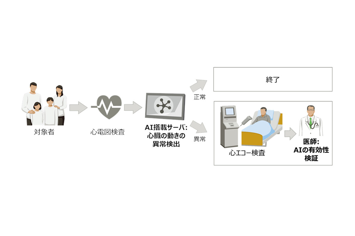 富士通×東大、心電図から心臓の異常を推定するAIの臨床研究を開始