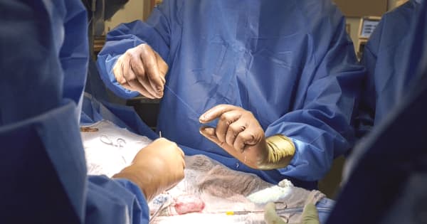 ブタの腎臓、ヒトに試験的に移植　米外科医チーム