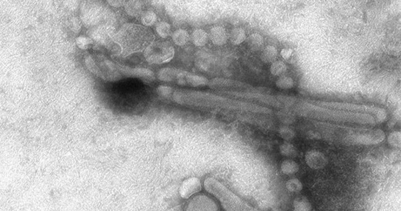 インフルエンザの季節に朗報！コロナ対策のお陰で「ある型」が絶滅した可能性 - ヘルスデーニュース