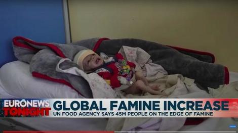 アフガニスタンの小児病院で25人が餓死、医師は無給