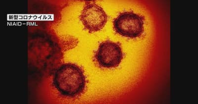 【速報】新潟県内で１人感染確認　新潟市１人　新潟市以外はゼロ　新型コロナウイルス