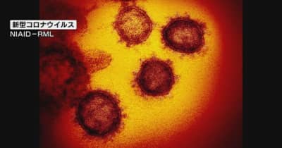 【速報】新潟県内で１人感染確認　新潟市以外で１人　新潟市０人　　新型コロナウイルス