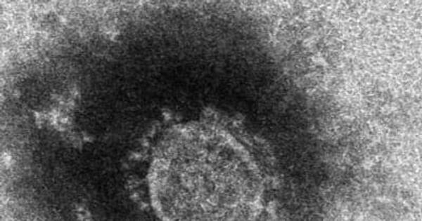 新潟県内で新たに新型コロナウイルス感染症患者２人、新潟市の新規感染者はゼロ