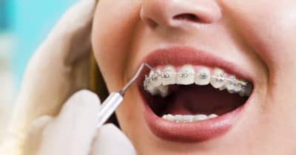 歯の矯正で医療費控除を利用する場合の手続きって？