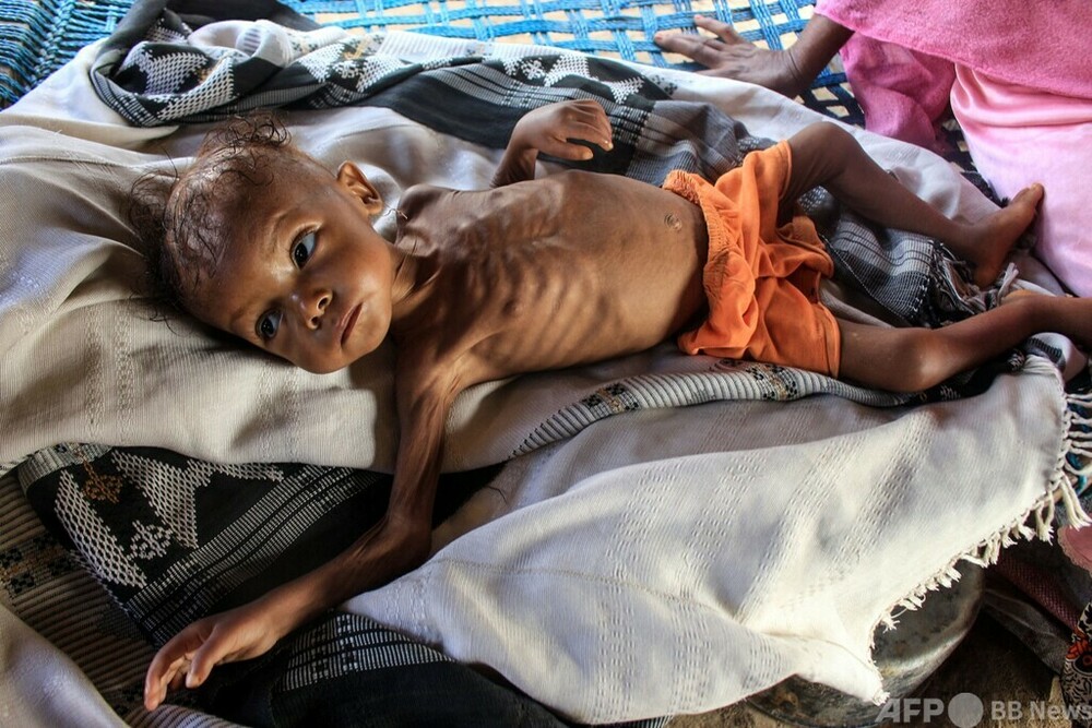 国連食糧計画、イエメン支援「削減せざるを得ない」 資金難で