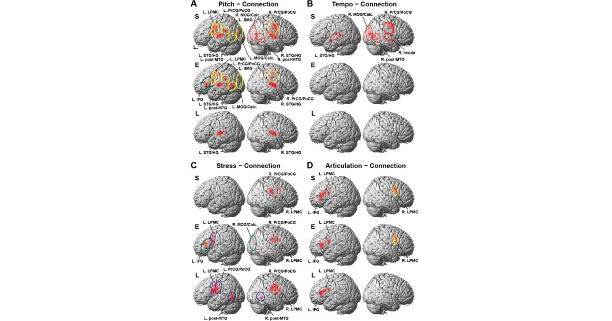 早期の楽器演奏の習得で音楽判断に対する脳活動が活発化、東大などが確認