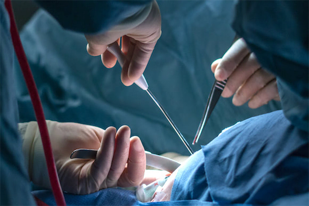 30秒糸結び、運針。「YouTubeで外科手術訓練」の医師たち