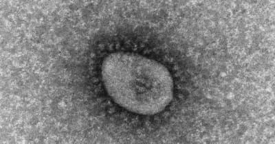 【速報】「オミクロン株」の感染　新潟県内で初確認　新型コロナウイルス