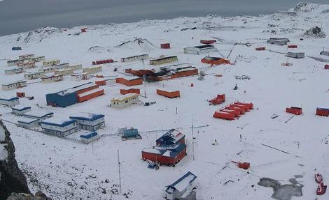 南極に引っ越す人が、事前に必ず受けなければならない「手術」とは？