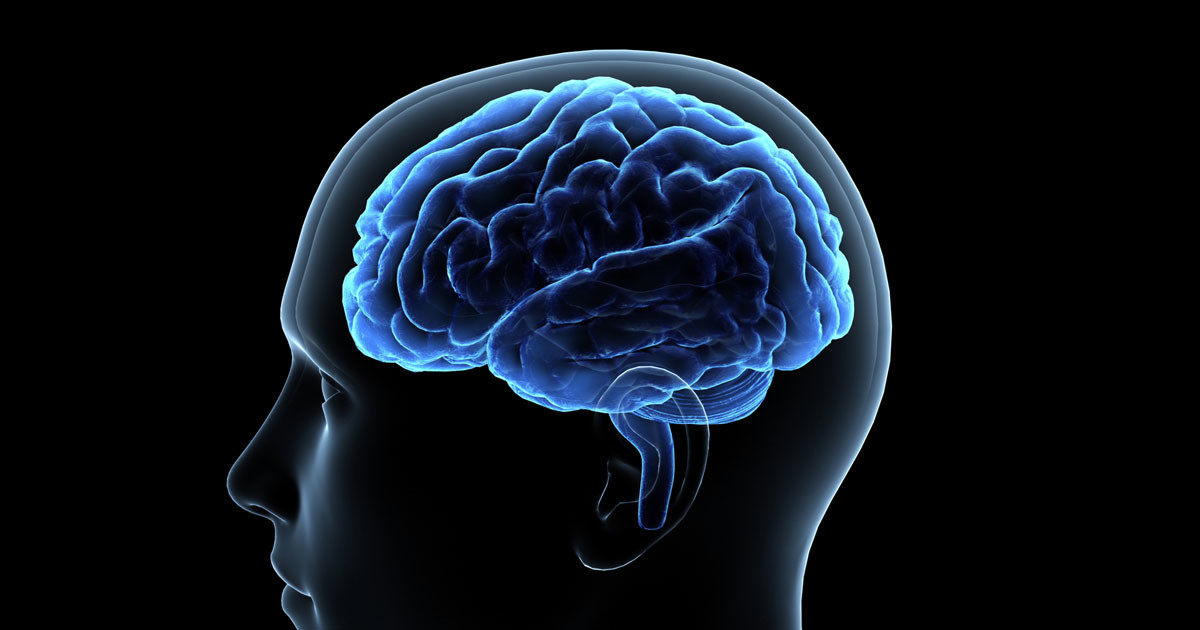 エム、脳画像ビッグデータをAI分析で開発した認知症リスク評価のプログラム