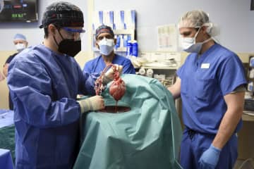 世界初のブタ心臓移植の男性死亡　米メリーランド大発表