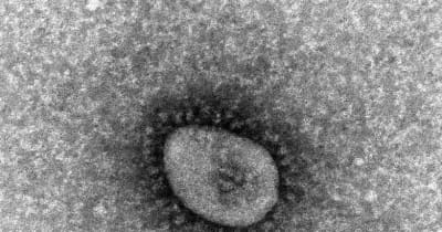 【速報】新潟市保健所管内を含む県内で新型コロナウイルス感染症の新規患者が２４０人程度の見込み