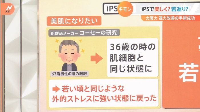大阪大、iPS細胞で視力著しく改善　将来は薄毛の悩みも解消