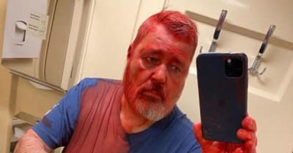 ノーベル平和賞のロシア紙編集長が襲撃される。頭から赤いペンキをかけられた姿を投稿