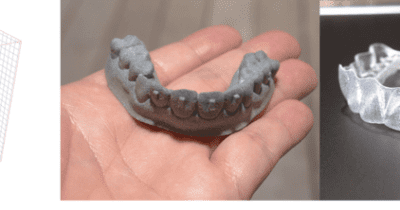 3Dプリンターを活用した、 歯科矯正用マウスピースの製造、配送サービスを5月18日から開始