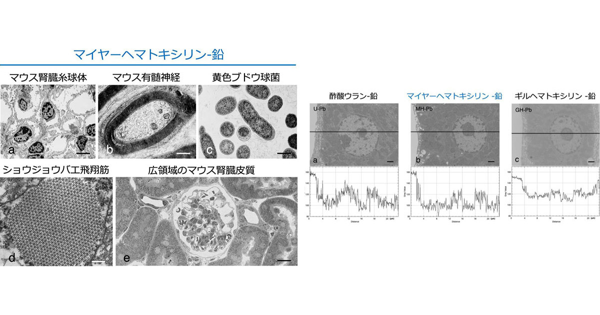 東京保健医療専門職大など、従来の酢酸ウランに代わる電顕用染色法を開発