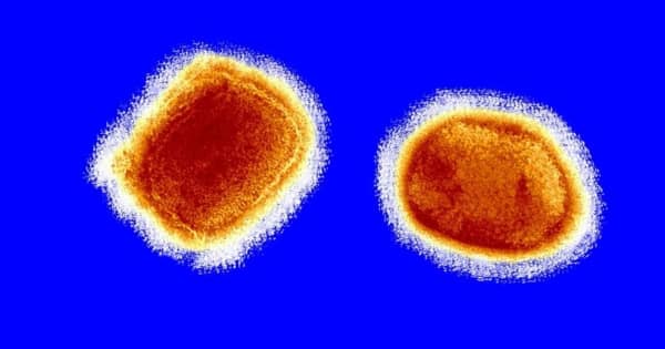 「サル痘」の感染報告、欧米などで相次ぐ　保健当局が調査