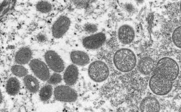 「サル痘」、12カ国に拡大　80人感染、WHO警戒