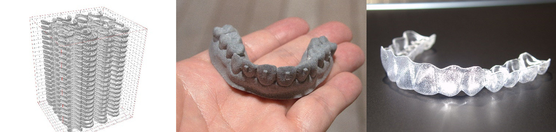 ヤマト運輸とDRIPSがマウスピースによる歯科矯正に革新、3Dプリンタ活用で