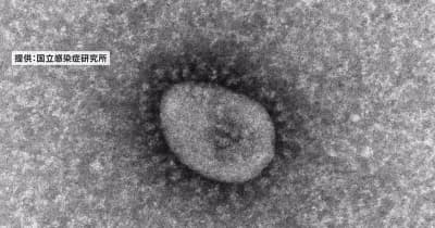 【速報】新潟市で31人感染確認 新型コロナウイルス