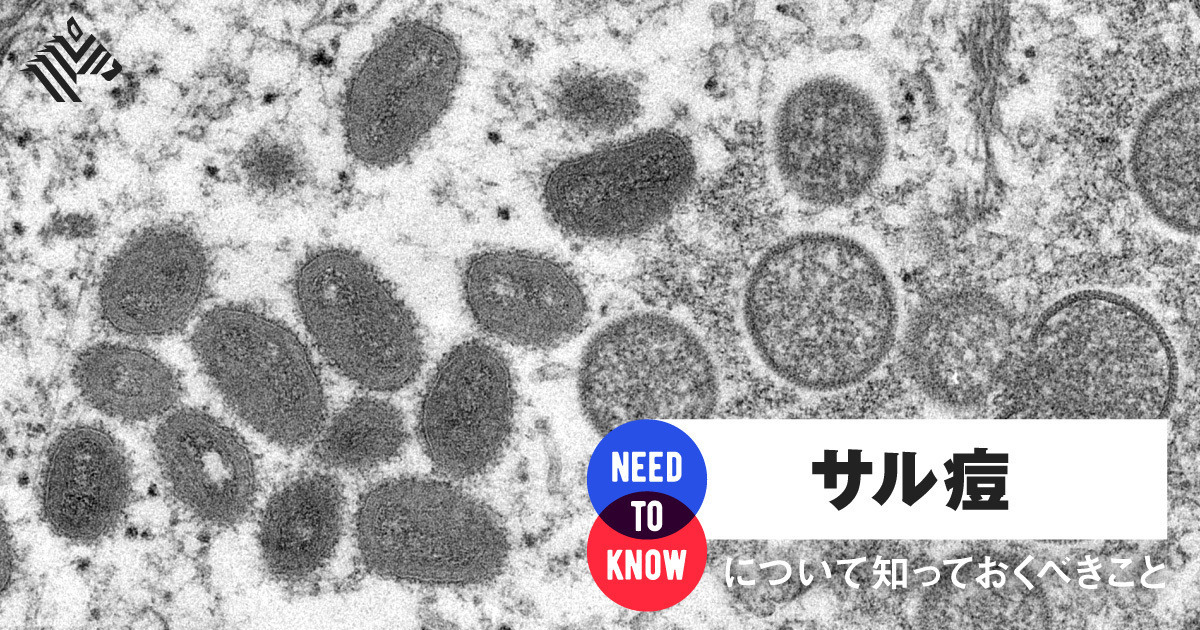 【7月29日更新】天然痘ワクチン、サル痘予防用で承認へ