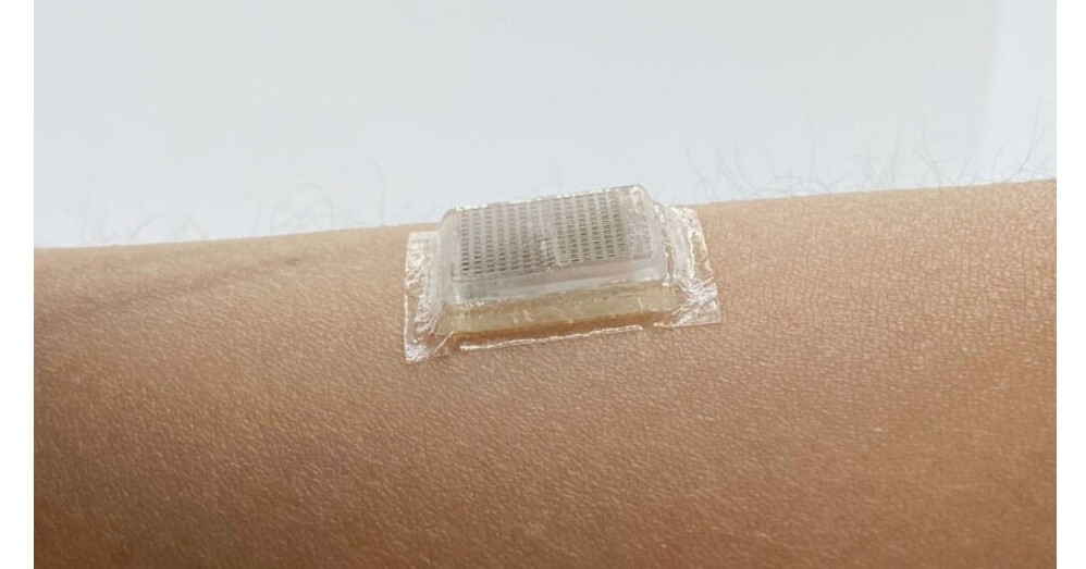 皮膚に貼って超音波検査できるステッカー、米MITなどが開発　どこにいても胎児をエコーで見られる未来へ