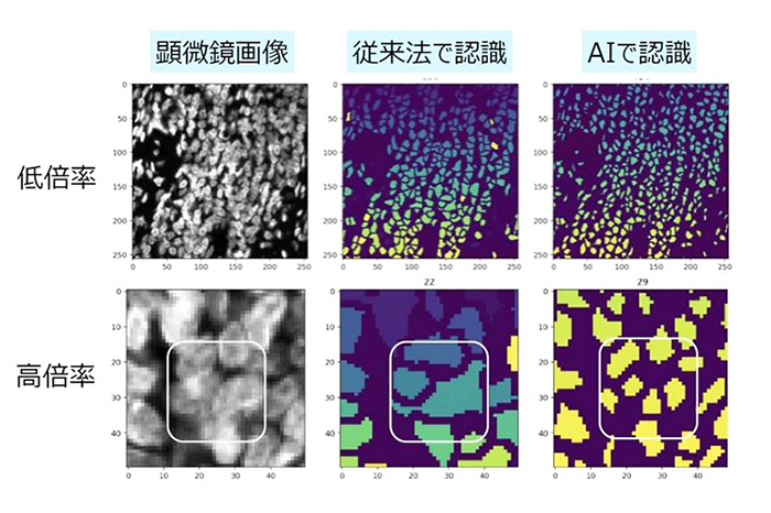 オープンイノベ推進、第一三共が示した画像ＡＩ解析の効果