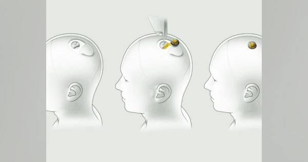 E・マスク氏、脳インプラント企業Neuralinkの進捗を10月31日に発表へ