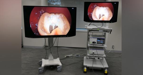 ソニーとオリンパスの協業がさらに進化、“全部入り”外科手術用内視鏡を開発