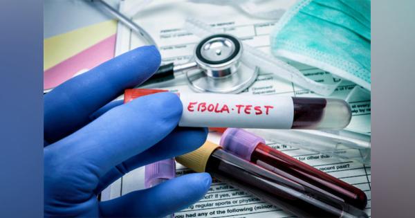 米CDC、エボラ出血熱への警戒を強化　ウガンダからの入国を一部制限