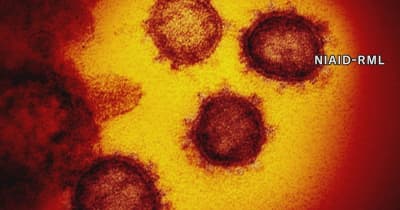 【速報】新型コロナ 大分県内で171人感染確認 クラスター1件