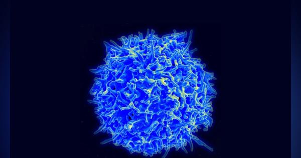 自己免疫疾患には、患者自身の細胞を“改変”する手法が効果あり：ドイツの研究チームが広げた「T細胞」の可能性