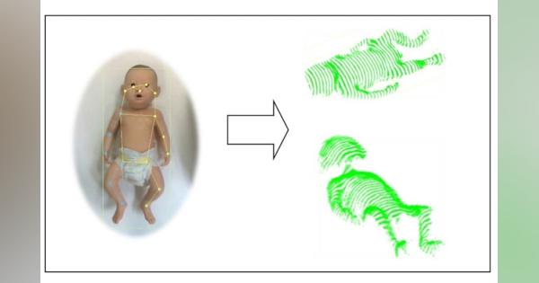 新生児に触れずに体重を計測｜3Dカメラによる新生児身体測定システムを展示