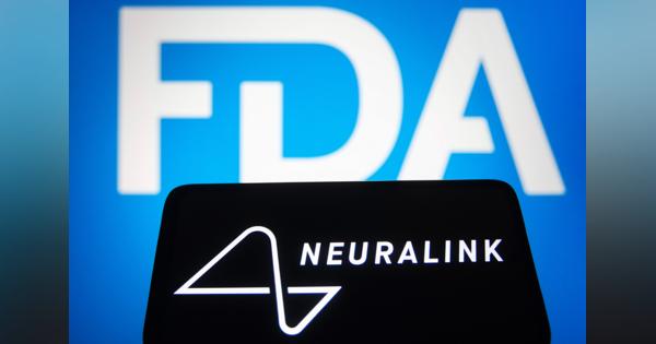 米FDA、イーロン・マスクの「脳デバイス」の人体実験を却下
