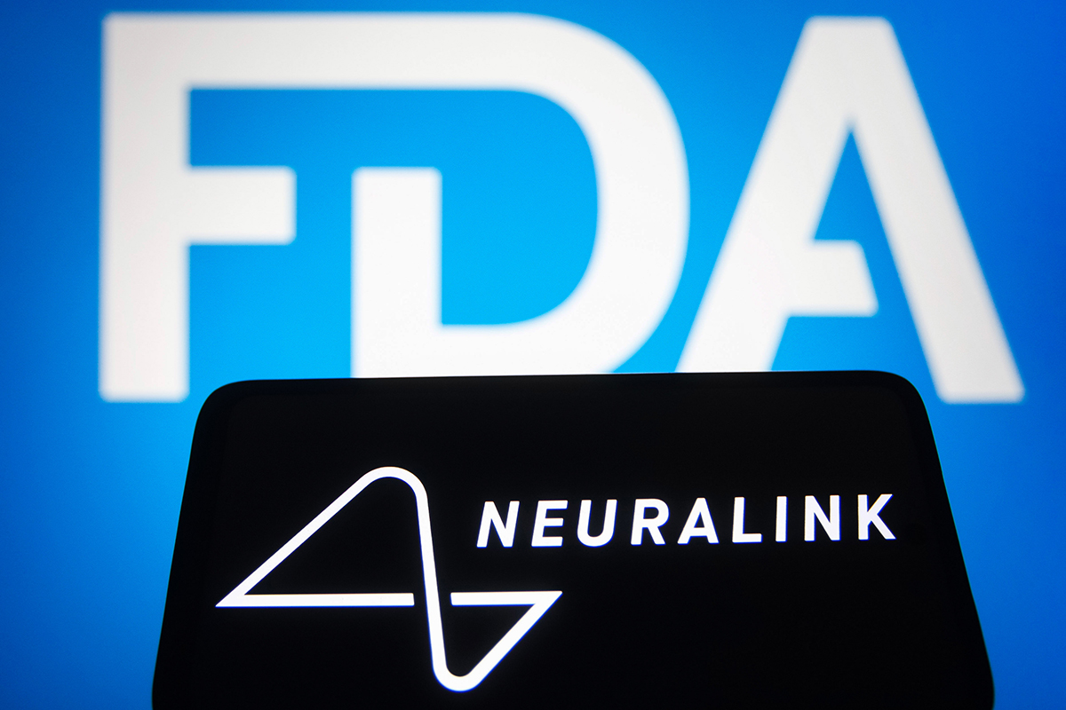 米FDA、イーロン・マスクの「脳デバイス」の人体実験を却下