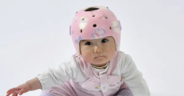 グンゼ、乳児の矯正具開発　ヘルメットで頭部丸く