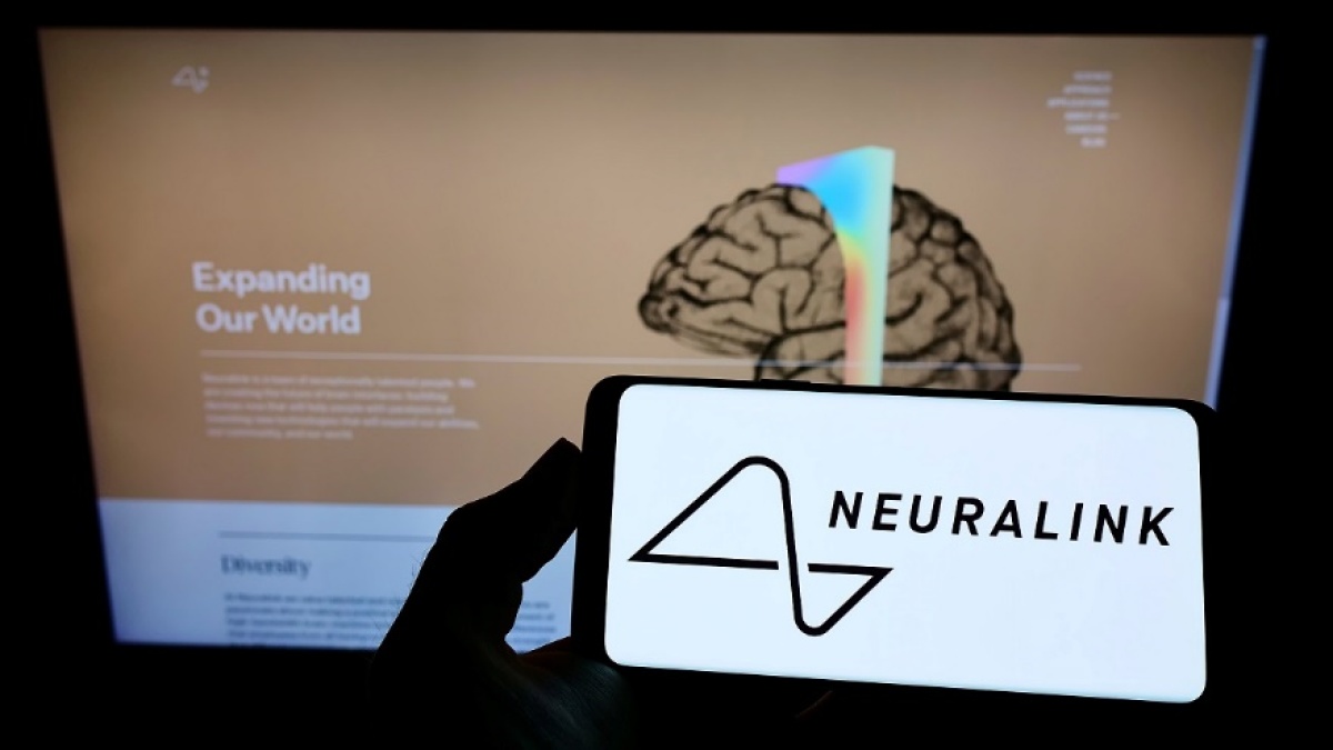イーロン・マスクの「ニューラリンク」とは？ 脳デバイス（BCI）企業に大注目のワケ