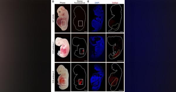 豚の体内で“人間の臓器”の成長に成功　中国の研究者らが発表　移植用臓器不足の軽減を目指す
