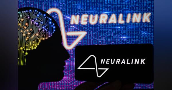 ニューラリンクの脳インプラントで「AIの脅威低減」 マスクが主張