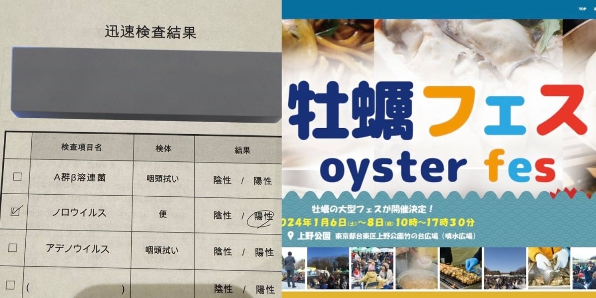 上野公園「牡蠣フェス」参加者がノロウイルス陽性「運営から謝罪あった」、体調不良の投稿相次ぐ