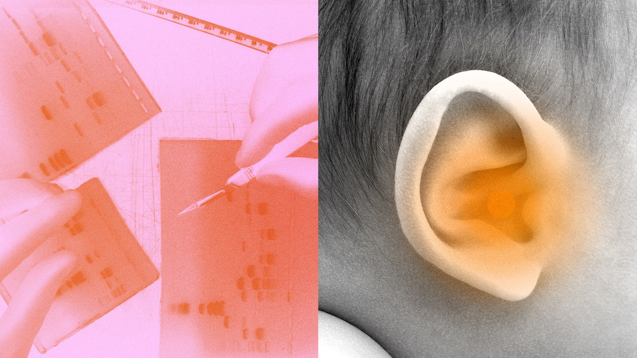 注射1回の遺伝子治療でタンパク質を復元、生まれつき難聴だった子どもの耳が聞こえるように