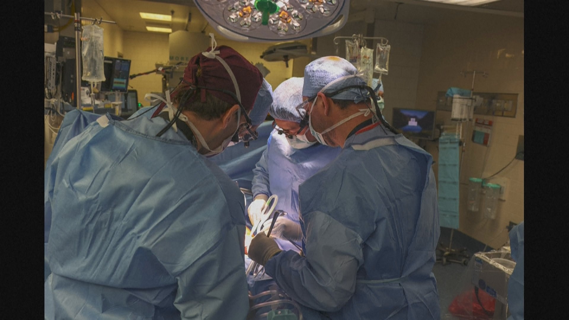 世界初ブタ腎臓移植の患者が死亡　順調回復も術後2か月で 「移植が原因で亡くなったとは見られない」