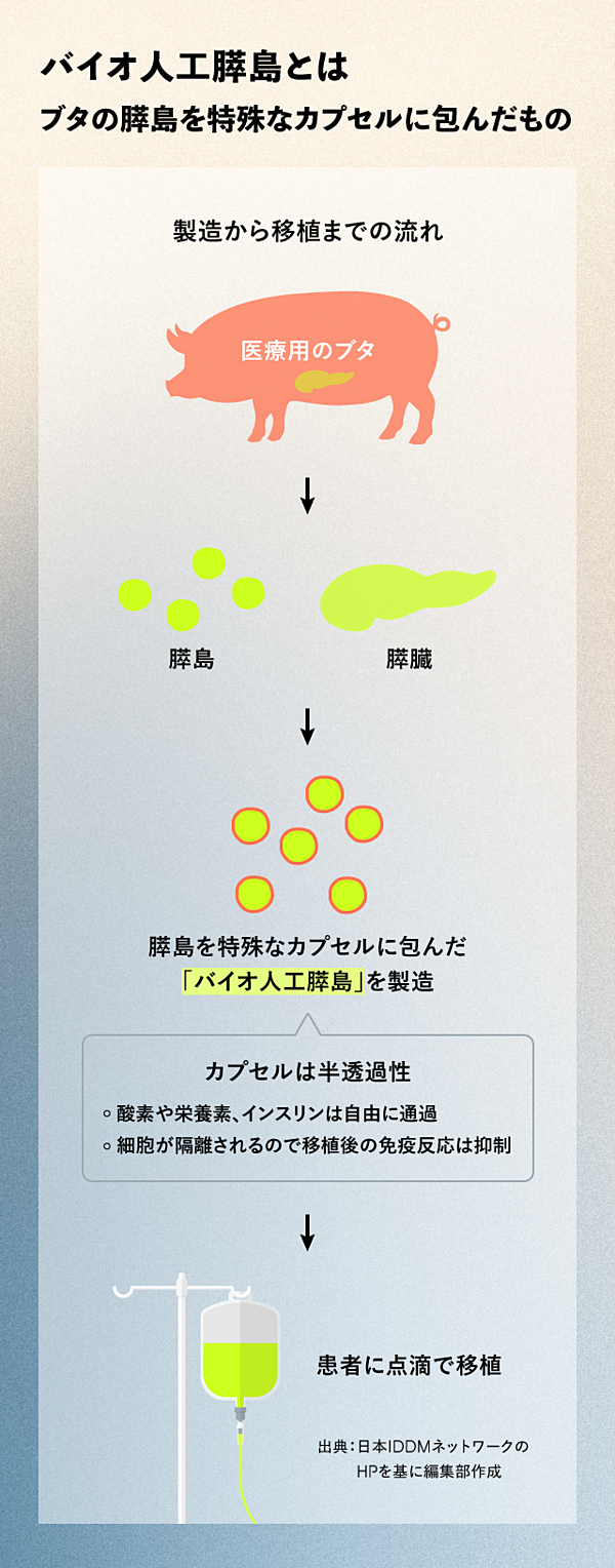 臓器移植実験マニュアル 異種移植＞（上） ブタの臓器をヒトに 米で腎臓移植 退院後に