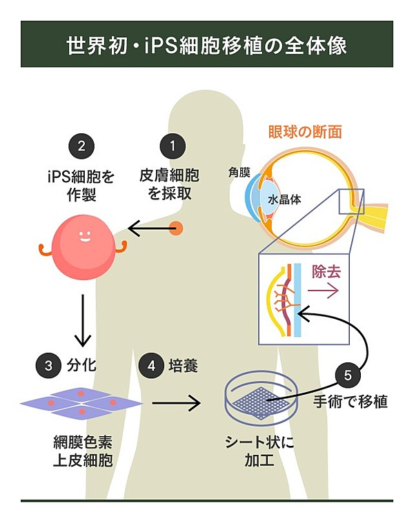 新証言 Ipsと山中教授を知り尽くす科学者 真相を語る