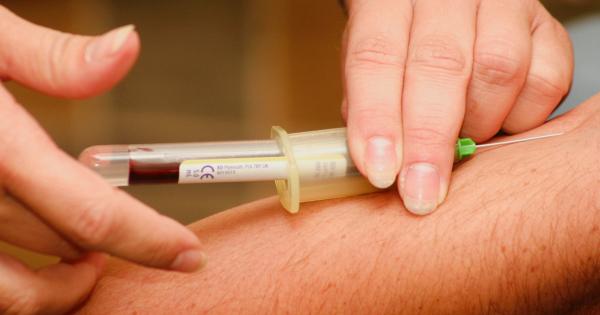 薬局で血液検査は購入できるようになるか：OTC化の議論が進む